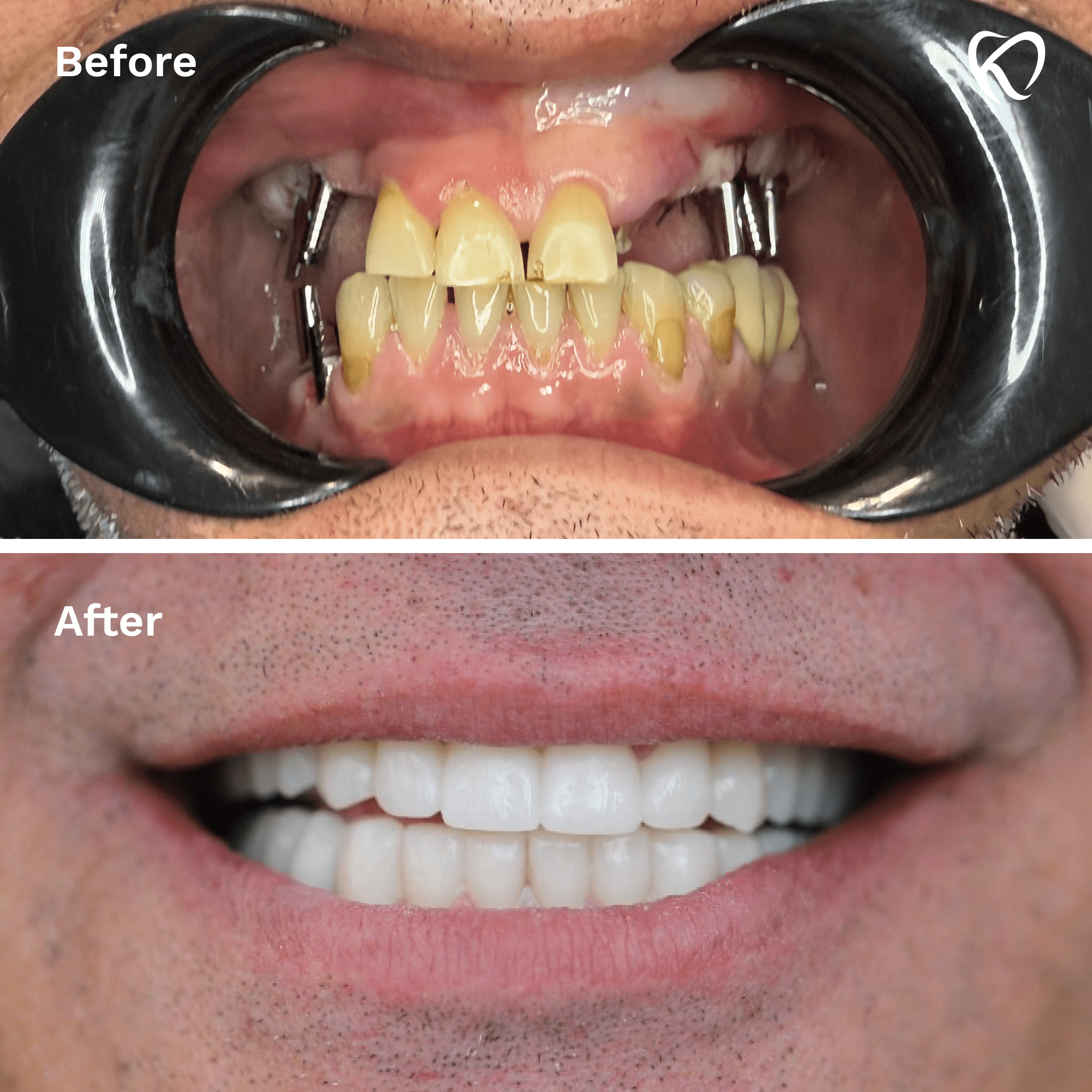 bc2Artboard 1 copy 9@3x